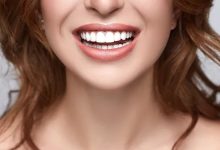 تبيِّض الأسنان طبيعياً