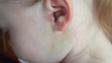صدمة أم بسبب ما عثرت عليه داخل أذن طفلتها.. وتحذير للآباء