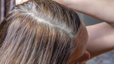 نقص الميلانين في الشعر.. 6 أسباب تؤدي إليه وطرق بسيطة للعلاج