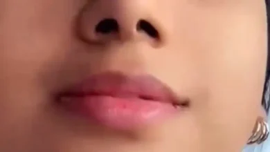 طفلة تخضع للتجميل في الكويت.. والسلطات تحقق (فيديو)
