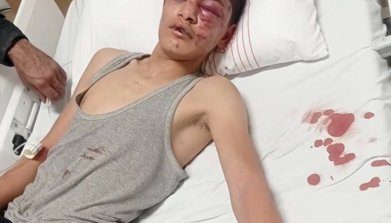 تعذيب وحشي لطفل سوري بتركيا يشعل مواقع التواصل