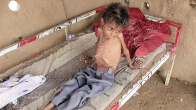 اليمنيون أصبحوا يعيشون أوضاع اقتصادية صعبة مع تواصل جرائم الحوثي