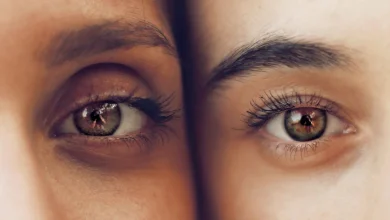الهالات السوداء عند الأطفال.. متى تكون طبيعية ومتى تدعو للقلق؟