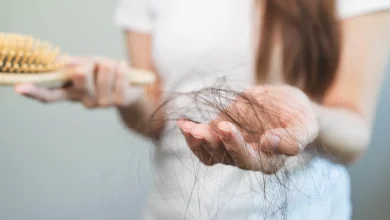 أسباب لتساقط الشعر في الشتاء