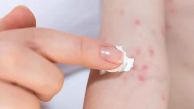 تعيش معك بصمت.. تعرف على أكثر 5 مهيجات للحساسية داخل البيت
