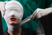 وفاة عروس مصرية إثر مضاعفات جلسة تجميل تثير جدلاً واسعاً (صورة)