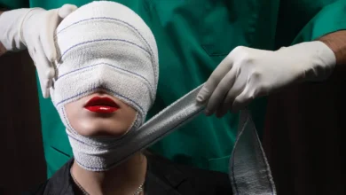 وفاة عروس مصرية إثر مضاعفات جلسة تجميل تثير جدلاً واسعاً (صورة)