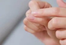 أطباء يحذرون: الأظافر الهشة قد تكشف أمراضًا خطيرة