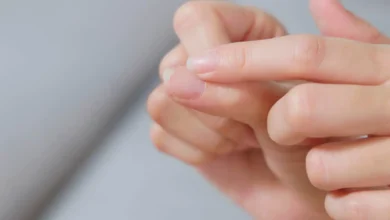 أطباء يحذرون: الأظافر الهشة قد تكشف أمراضًا خطيرة