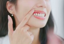 تحذير طبي جديد.. التهابات اللثة مرتبطة بتدهور أنسجة الدماغ