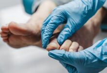 علاج ثوري للأظافر المتصلبة يدخل مرحلة التجارب النهائية