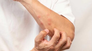 العلوم تشرح سر تعلق البعوض ببعضنا أكثر من الآخرين