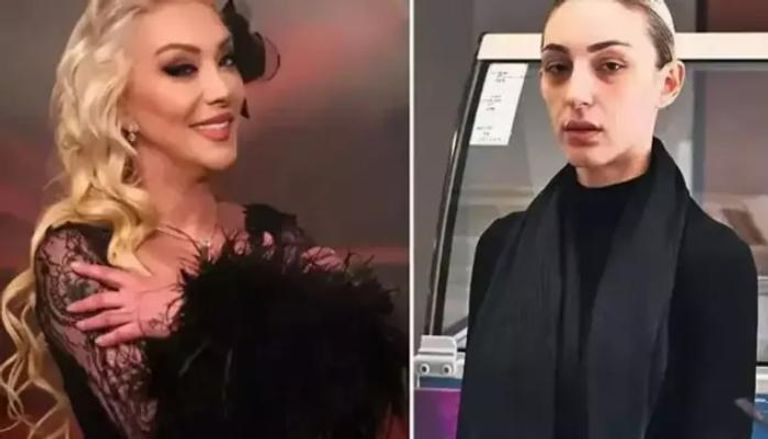 قضية تهز الوسط الفني: هل قتلت ابنة غوللو والدتها؟