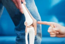 ابتكار طبي جديد يعيد بناء الغضاريف التالفة لأول مرة