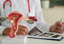 هل بطانة الرحم المهاجرة تصل إلى أعضاء أخرى مثل القلب والرئتين؟