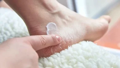 تقرحات القدم مع الحرارة.. كيف تعالج الكالوس بطرق آمنة؟