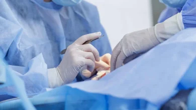 مضاعفات خطيرة لجراحة تجميلية تحرم امرأة من إغلاق جفنيها