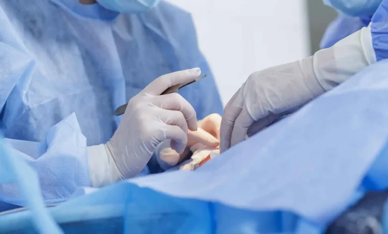 مضاعفات خطيرة لجراحة تجميلية تحرم امرأة من إغلاق جفنيها