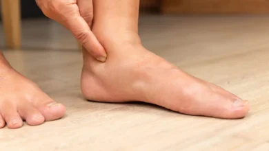 علامات احتباس السوائل.. متى تستدعي زيارة الطبيب؟