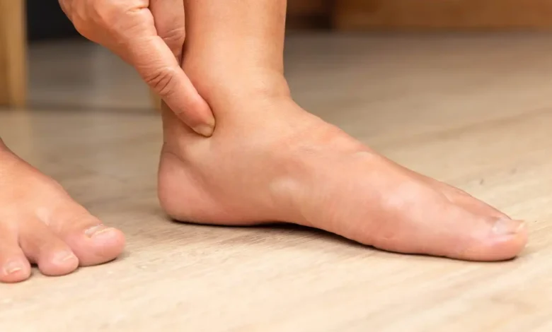 علامات احتباس السوائل.. متى تستدعي زيارة الطبيب؟