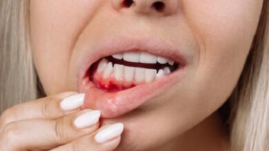 لا تتجاهل نزيف اللثة.. فقد يكون مؤشرًا على خطر صحي أكبر