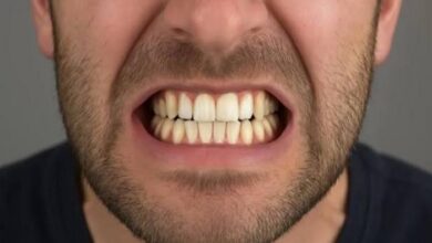 أسنانك تدفع ثمن التوتر.. لماذا يزداد صرير الأسنان بين الشباب؟