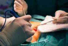 قلب مزروع يعيش بجسد جديد.. فهل يشيخ بعمر صاحبه السابق؟