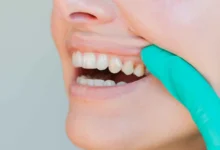 لماذا تغيّر ملمس أسنانك؟.. أسباب بسيطة وأخرى تستدعي الحذر