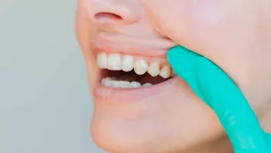 لماذا تغيّر ملمس أسنانك؟.. أسباب بسيطة وأخرى تستدعي الحذر